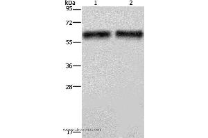 Western blot analysis of Human hepatocellular carcinoma tissue, using ELN Polyclonal Antibody at dilution of 1:400 (Elastin Antikörper)