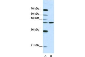 Western Blotting (WB) image for anti-Neuromedin U Receptor 2 (NMUR2) antibody (ABIN2461125) (NMUR2 Antikörper)