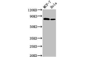 Western Blot Positive WB detected in: MCF-7 whole cell lysate, Hela whole cell lysate All lanes: BCAR1 antibody at 3. (BCAR1 Antikörper  (AA 68-218))