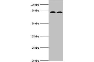 Western blot All lanes: AMP deaminase 3 antibody at 2 μg/mL Lane 1: NIH/3T3 whole cell lysate Lane 2: 293T whole cell lysate Lane 3: Mouse lung tissue Secondary Goat polyclonal to rabbit IgG at 1/10000 dilution Predicted band size: 89, 25, 77, 90, 72 kDa Observed band size: 89 kDa (AMPD3 Antikörper  (AA 1-260))