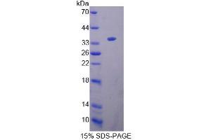 SDS-PAGE (SDS) image for Kell Blood Group, Metallo-Endopeptidase (KEL) (AA 49-358) protein (His tag) (ABIN6239034) (KEL Protein (AA 49-358) (His tag))