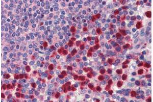Human Spleen (formalin-fixed, paraffin-embedded) stained with TRIM35 antibody ABIN462195 followed by biotinylated goat anti-rabbit IgG secondary antibody ABIN481713, alkaline phosphatase-streptavidin and chromogen. (TRIM35 Antikörper  (AA 359-408))