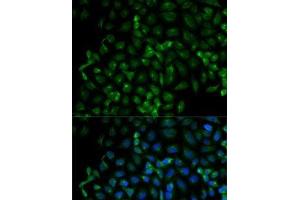 Immunofluorescence analysis of HeLa cells using Beta-TRCP Polyclonal Antibody (beta-TrCP Antikörper)