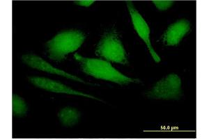 Immunofluorescence of monoclonal antibody to HBXIP on HeLa cell.