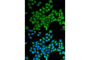 Immunofluorescence analysis of MCF-7 cells using DAO antibody (ABIN5973055). (D Amino Acid Oxidase Antikörper)