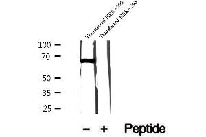 Western blot analysis of extracts of human skeletal muscle tissue, using FAM65B antibody. (FAM65B Antikörper)