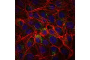 Immunofluorescence analysis of PC-2 cells using CD15 mouse mAb (green). (CD15 Antikörper)