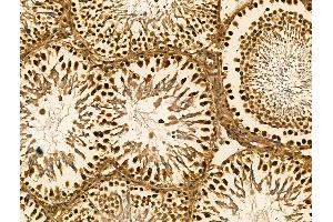 ABIN7094425 and ABIN7098472 at 1/100 staining Rat testis tissue by IHC-P. (SRSF2 Antikörper  (Internal Region))