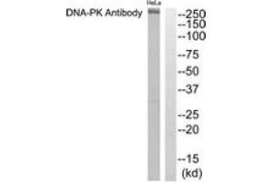 Western blot analysis of extracts from HeLa cells, using DNA-PK Antibody. (PRKDC Antikörper  (AA 4061-4110))
