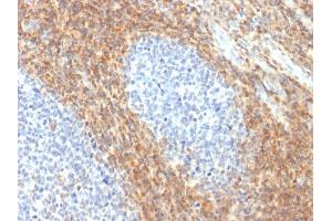 Formalin-fixed, paraffin-embedded human Tonsil stained with CD52 Rabbit Recombinant Monoclonal Antibody (CD52/2276R). (Rekombinanter CD52 Antikörper)