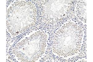 ABIN7095832 and ABIN7099894 at 1/100 staining rat testis tissue by IHC-P.