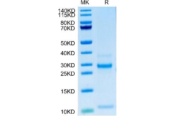 NOTCH3 Protein (AA 1378-1640) (His tag)