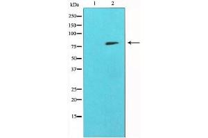 Western blot analysis of MMP-9 expression in HepG2 cells,The lane on the left is treated with the antigen-specific peptide.