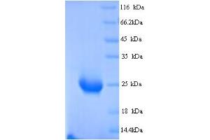 SDS-PAGE (SDS) image for butyrophilin, Subfamily 2, Member A1 (BTN2A1) (AA 29-248) protein (His tag) (ABIN5714396) (BTN2A1 Protein (AA 29-248) (His tag))
