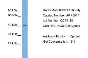 WB Suggested Anti-TFDP3  Antibody Titration: 0. (TFDP3 Antikörper  (Middle Region))