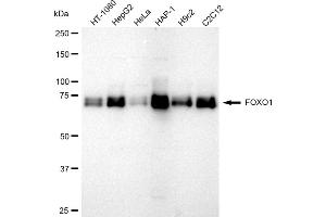 Western blotting analysis using FOXO1 antibody (ABIN7798643). (Rekombinanter FOXO1 Antikörper)