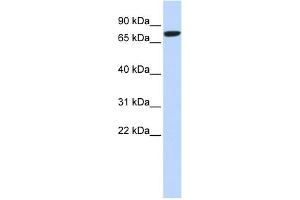 WB Suggested Anti-DLL1 Antibody Titration:  0. (DLL1 Antikörper  (N-Term))