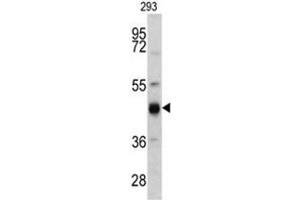 Western blot analysis of KRT13 antibody (N-term) in 293 cell line lysates (35ug/lane). (Cytokeratin 13 Antikörper  (N-Term))