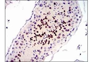 Immunohistochemical analysis of paraffin-embedded human testis tissues using CDK4 mouse mAb with DAB staining. (CDK4 Antikörper)