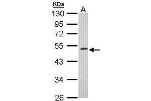 WB Image Sample (30 ug of whole cell lysate) A: Hep G2 , 10% SDS PAGE antibody diluted at 1:1000 (C17orf75 Antikörper)