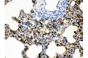 Immunohistochemistry (IHC) image for anti-Surfactant Associated Protein A2 (SFTPA2) (AA 206-237), (C-Term) antibody (ABIN3043922)