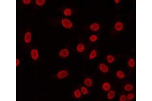 ABIN6268972 staining HeLa by IF/ICC. (Cyclin H Antikörper  (pThr315))