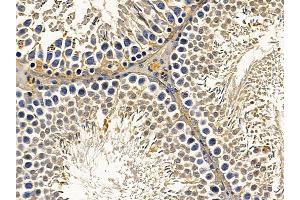 ABIN7094026 and ABIN7098070 at 1/100 staining rat testis tissue by IHC-P. (TRIM11 Antikörper  (N-Term))