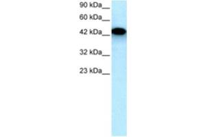 Western Blotting (WB) image for anti-Eyes Absent Homolog 3 (EYA3) antibody (ABIN2460428) (EYA3 Antikörper)