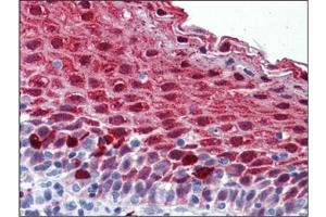 Human Tonsil: Formalin-Fixed, Paraffin-Embedded (FFPE) (MARK4 Antikörper  (Internal Region))