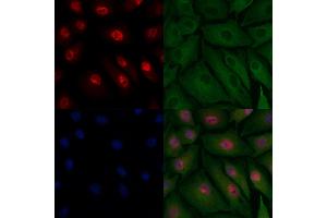 ABIN6262242 and ABIN6278080 staining  cells by IF/ICC. (HIPK2 Antikörper  (N-Term))