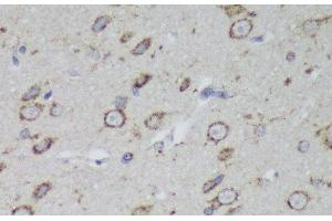Immunohistochemistry of paraffin-embedded Rat brain using PSAP Polyclonal Antibody at dilution of 1:200 (40x lens). (Prosaposin Antikörper)