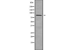 Western blot analysis of ZNF839 using HUVEC whole cell lysates (ZNF839 Antikörper  (Internal Region))