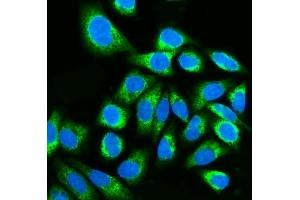 IF analysis of Kinectin 1/KTN1 using anti-Kinectin 1/KTN1 antibody (ABIN7601096). (KTN1 Antikörper  (AA 283-827))