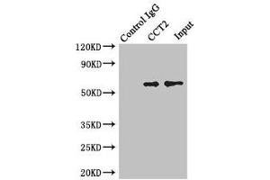 Immunoprecipitating CCT2 in Jurkat whole cell lysate Lane 1: Rabbit control IgG instead of (1 μg) instead of ABIN7171416 in Jurkat whole cell lysate. (CCT2 Antikörper  (AA 206-535))