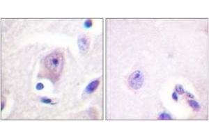 Immunohistochemistry analysis of paraffin-embedded human brain tissue, using CDC6 (Ab-54) Antibody. (CDC6 Antikörper  (AA 20-69))