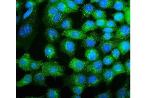 IF analysis of COPE using anti-COPE antibody (ABIN7602509).