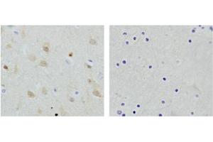 Immunohistochemistry analysis of human brain tissue slide (Paraffin embedded) using Rabbit Anti-NSE Polyclonal Antibody (Left, ABIN398879) and Purified Rabbit IgG (Whole molecule) Control (Right, ABIN398653)