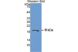 Western blot analysis of the recombinant protein. (ACP1 Antikörper  (AA 1-158))