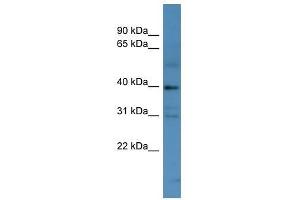 MAGEC2 antibody used at 0. (MAGEC2 Antikörper  (N-Term))