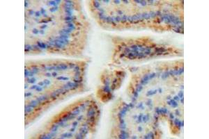 Used in DAB staining on fromalin fixed paraffin-embedded Bowels tissue (REG3A Antikörper  (AA 40-164))