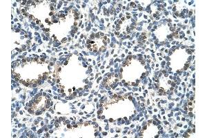 RAD23A antibody was used for immunohistochemistry at a concentration of 4-8 ug/ml to stain Alveolar cells (arrows) in Human Lung.