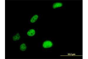 Immunofluorescence of purified MaxPab antibody to SLC4A1AP on HeLa cell. (NADAP Antikörper  (AA 1-796))