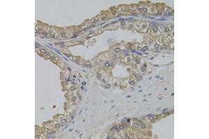 Immunohistochemistry of paraffin-embedded human prostate using ARF1 antibody. (ARF1 Antikörper)