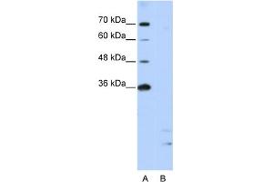 WB Suggested Anti-PPIE Antibody Titration:  2. (PPIE Antikörper  (Middle Region))