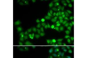 Immunofluorescence analysis of U2OS cells using POLK Polyclonal Antibody (POLK Antikörper)