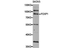 Western Blotting (WB) image for anti-Forkhead Box P1 (FOXP1) antibody (ABIN1876460) (FOXP1 Antikörper)