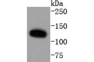 HeLa cell lysates probed with ERK5 (8D8) Monoclonal Antibody  at 1:1000 overnight at 4˚C. (MAPK7 Antikörper)
