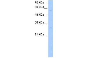 STEAP4 antibody used at 1 ug/ml to detect target protein. (STEAP4 Antikörper  (C-Term))