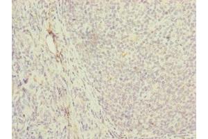 Immunohistochemistry of paraffin-embedded human tonsil tissue using ABIN7142250 at dilution of 1:100 (MRPS16 Antikörper  (AA 1-137))