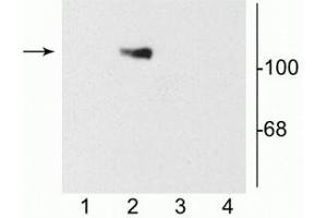 Western blot of 10 µg of HEK 293 cells showing specific immunolabeling of the ~120 kDa NR1 subunit of the NMDA receptor containing the C2 splice variant insert (lane 2). (GRIN1/NMDAR1 Antikörper)
